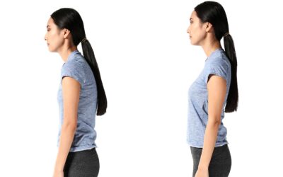 Postura de hombros caídos: consecuencias y tratamientos